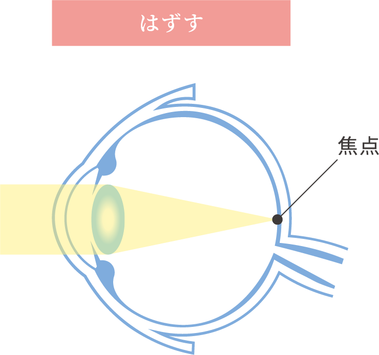 はずす