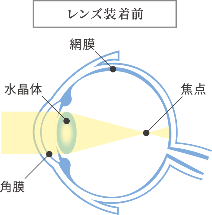 レンズ装着前